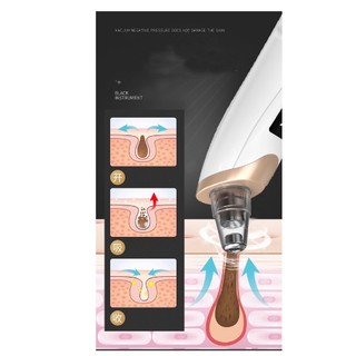Máy Hút Mụn Đầu Đen Làm Sạch Da Mặt Sạc Pin [ 5 Đầu Hút}