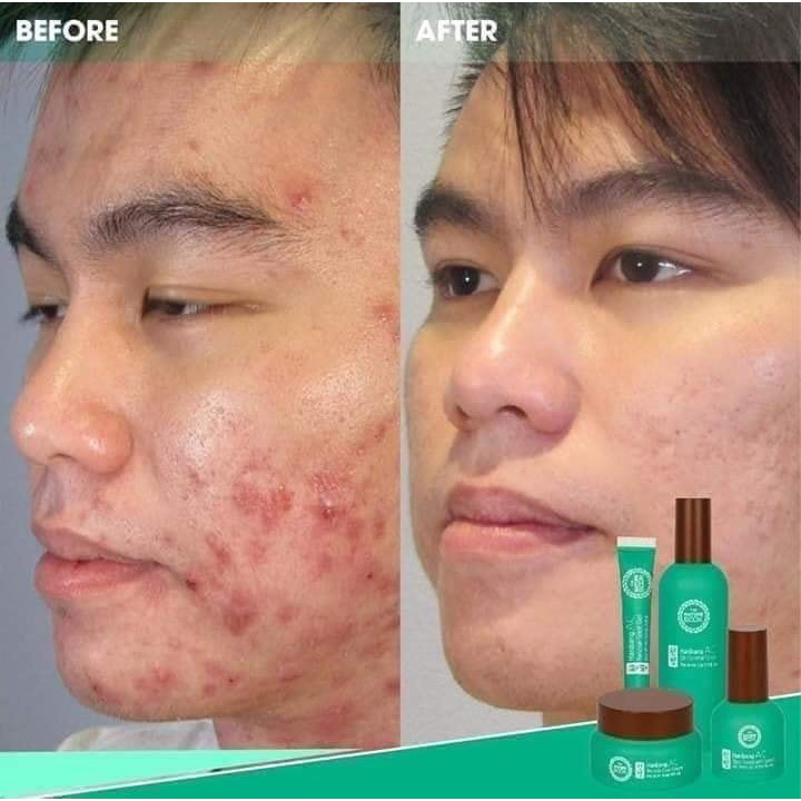 Kem dưỡng phục hồi da hư tổn Đông Y Hàn Quốc Hanbang AC Trouble Care Cream