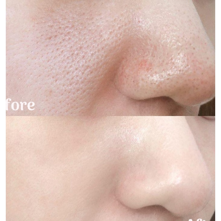 Gói dùng thử tinh chất Red Peel So's Natural Red Peed Tingle Serum 2.5ml
