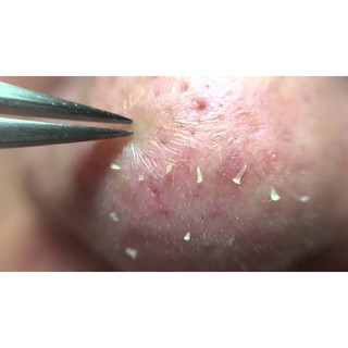 Nhíp nhổ mụn, nhíp nối mi, nhíp gắp thịt kẹt kẽ răng, díp nhổ mụn kẹp đa năng