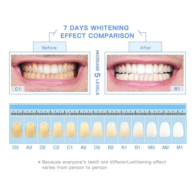 Bút Gel Làm Trắng Răng Không Đau Hiệu Quả YOUYO