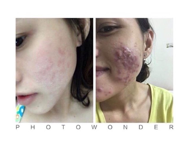 Serum thảo mộc LÁRE (THANH DƯỢC) 100% thiên nhiên | BigBuy360 - bigbuy360.vn