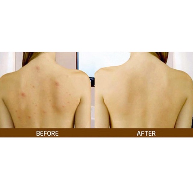 Sữa tắm A-DERMA cho cả nhà 500ml mẫu mới | BigBuy360 - bigbuy360.vn