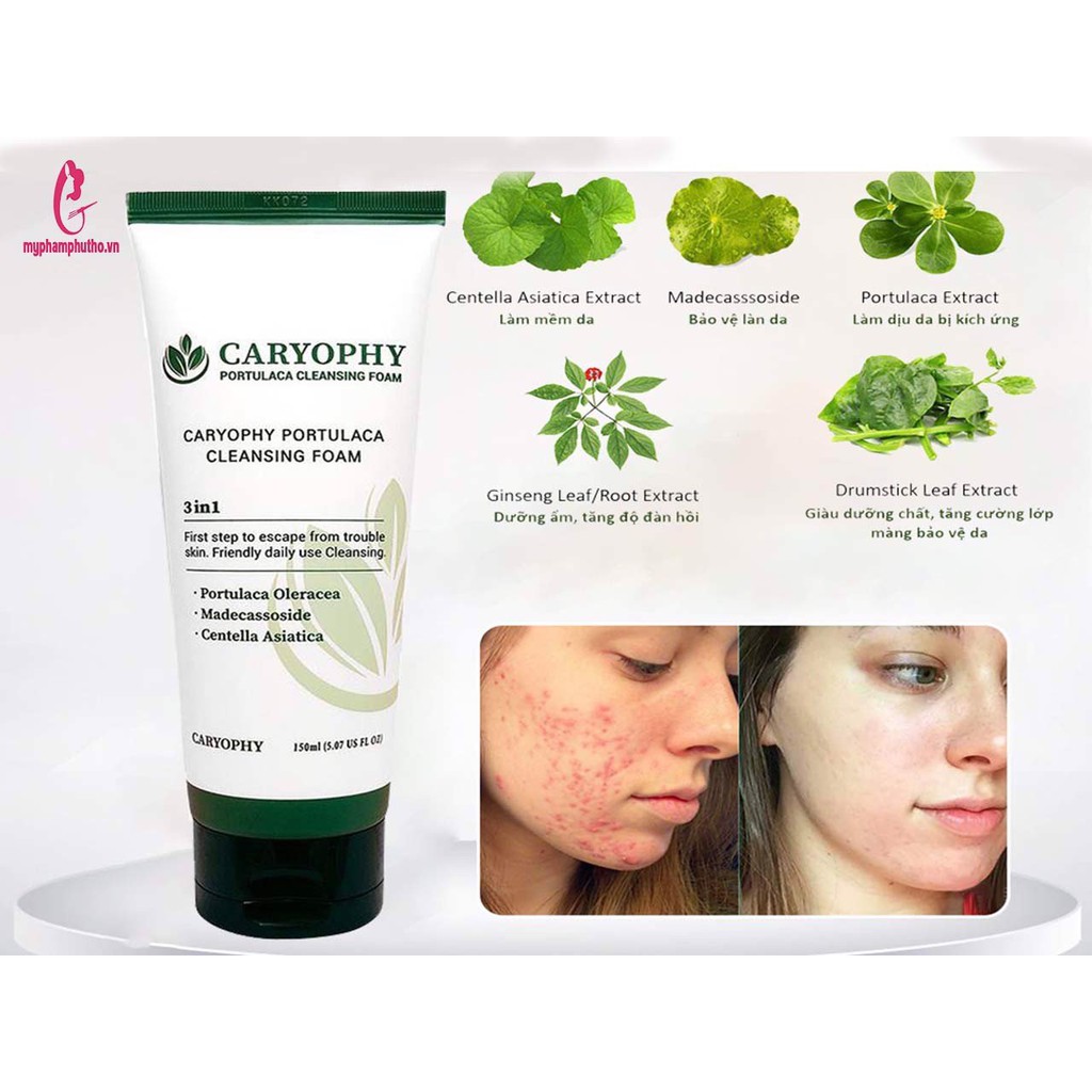 Sữa Rửa Mặt Làm Sạch Mụn Thâm Caryophy PORTULACA CLEANSING FOAM 150ML