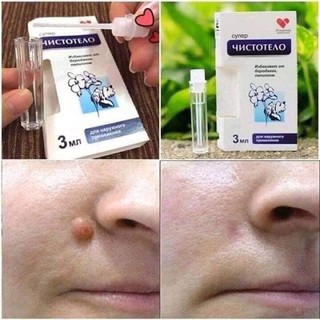GEL TẨY NUỐT RUỒI NGA