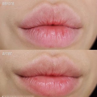Tinh Chất Dưỡng Môi Bubi Bubi Lip Ampoule