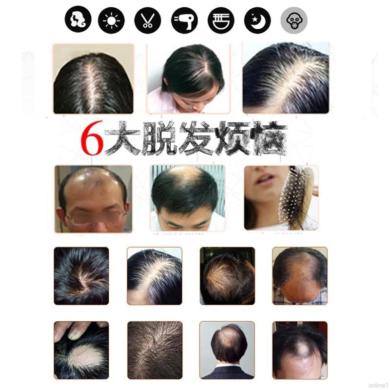 [Hàng mới về] Serum trị liệu dưỡng và chống rụng tóc tinh chất gừng