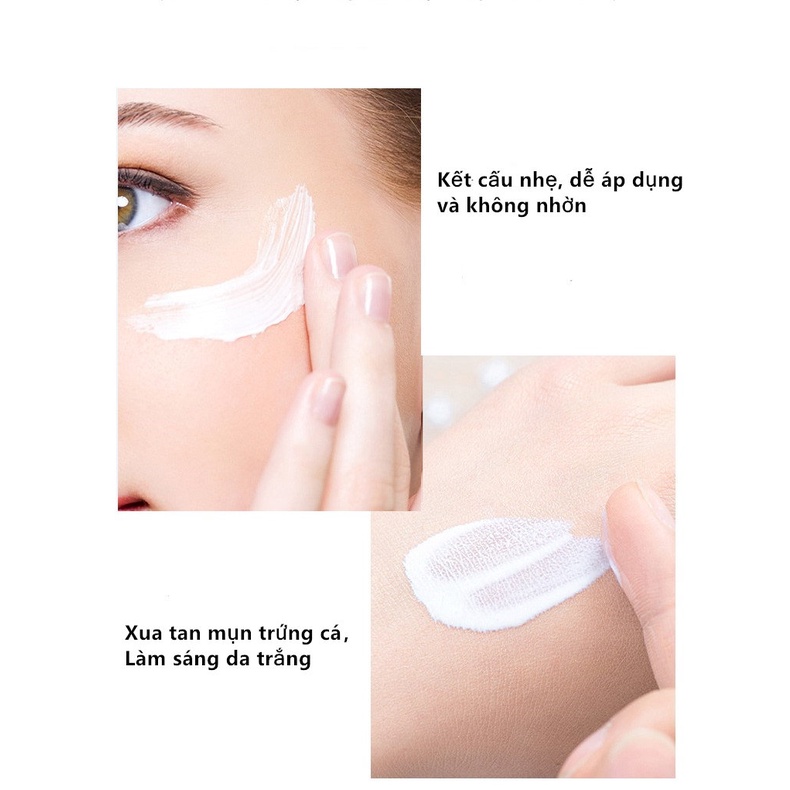 Venzen Gel Hỗ trợ giảm mụn Và Tàn Nhang Dưỡng Ẩm Làm Sáng Da Dịu Nhẹ