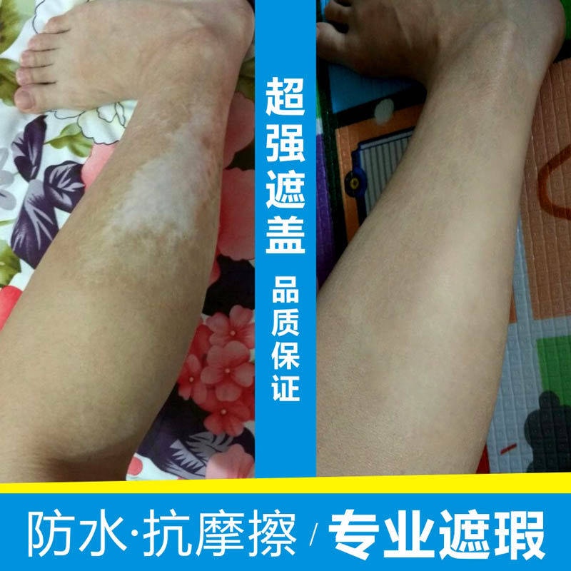 Miếng Dán Hình Xăm Che Phủ Vết Sẹo Và Da Vô Hình Màu Da Vô Hình