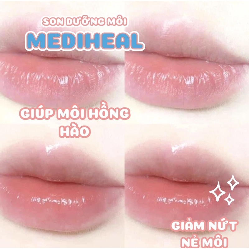 Son Dưỡng Môi Mediheal Labocare Pantenolips 10ml