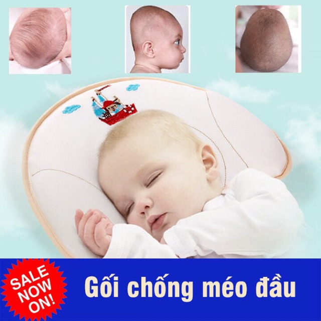 Gối chống bẹt đầu Babymoov chính hãng