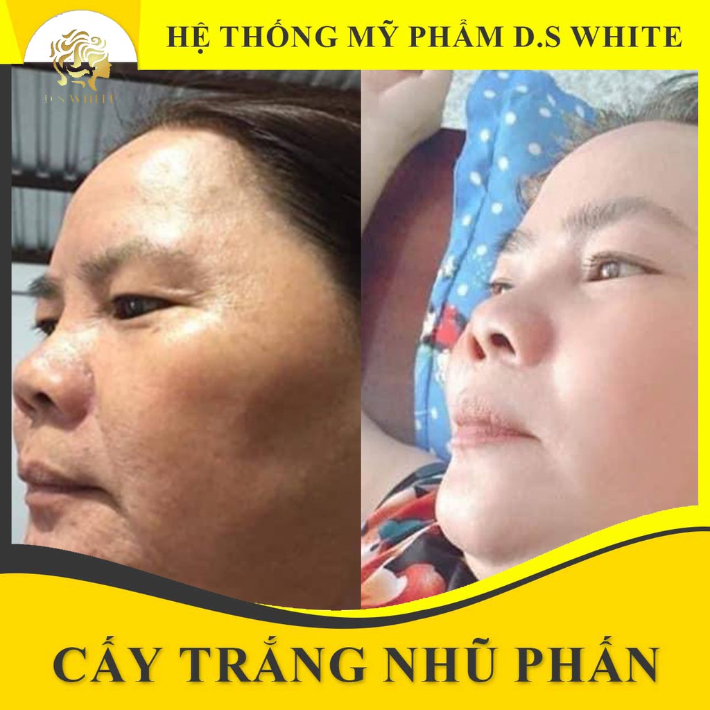 Cấy Trắng Da D.S White Chính Hãng - 3 Bước Trắng Da Tại Nhà Từ Nhũ Phấn Hoa