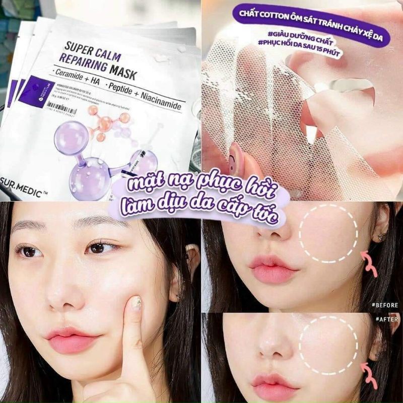 MẶT NẠ PHỤC HỒI LÀM DỊU DA SUR.MEDIC SUPER CALM