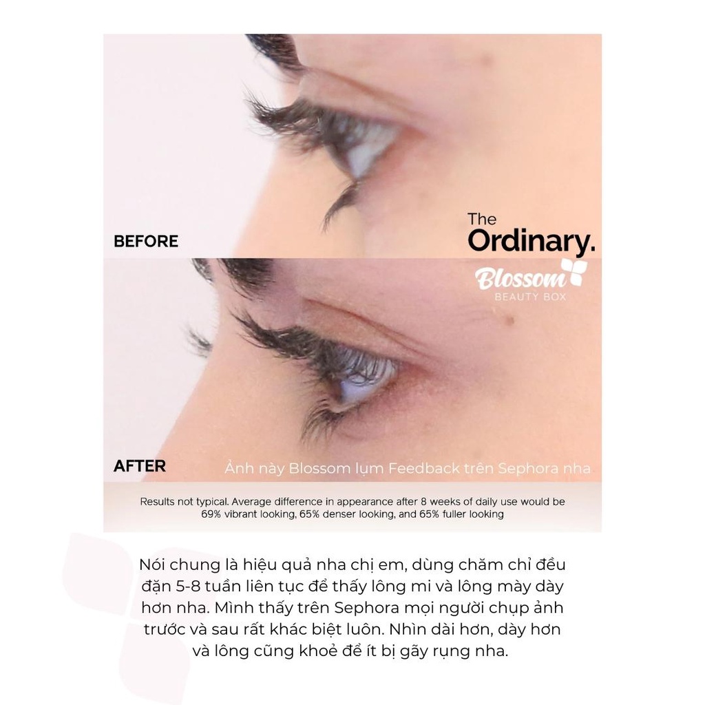 Serum dưỡng mi The Ordinary Multi-Peptide Lash and Brow 5ml