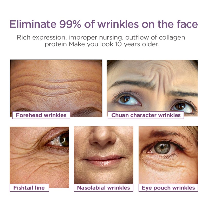 Kem dưỡng Youngbook dưỡng ẩm nâng cơ làm săn chắc da mặt chống lão hóa 25g | BigBuy360 - bigbuy360.vn