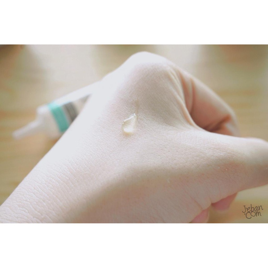 Kem Hỗ Trợ Trị Mụn 4 Tác Dụng Vitara Anti Acne Gel - BER25