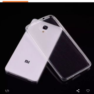 Ốp dẻo cao cấp xiaomi mi4