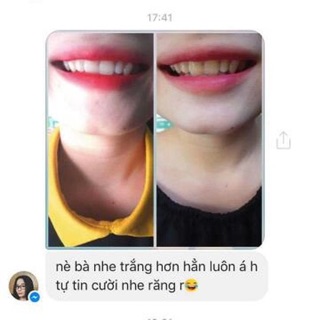 Miếng dán trắng răng Crest Whitestrips Supereme