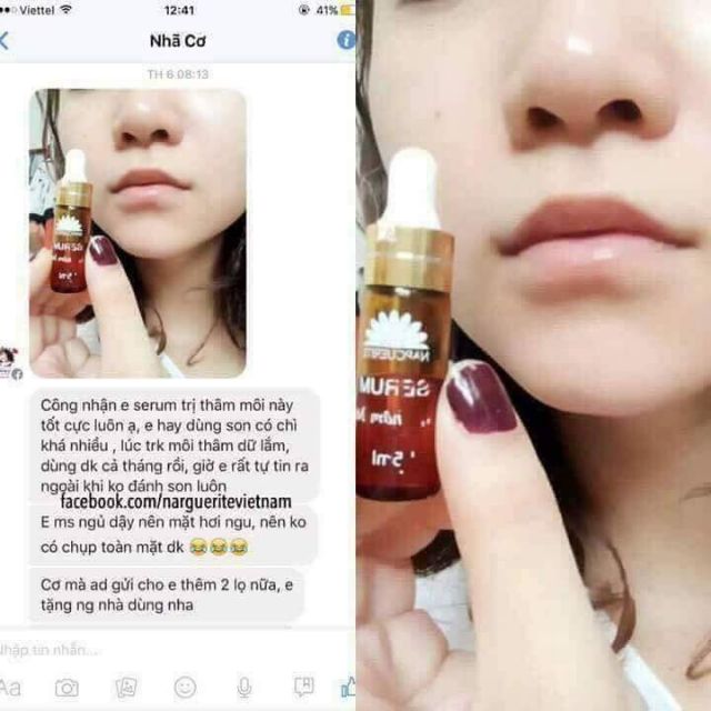 [ Mẫu Mới ] SERUM DƯỠNG MÔI/ GIẢM THÂM MÔI CỦA NARGUERITE | BigBuy360 - bigbuy360.vn