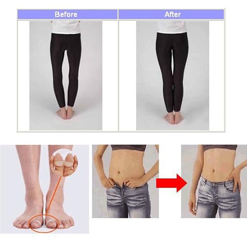 Set 2 vòng từ tính đeo ngón chân chất liệu silicon chất lượng cao