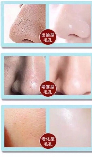 Serum Shrinkage Pore