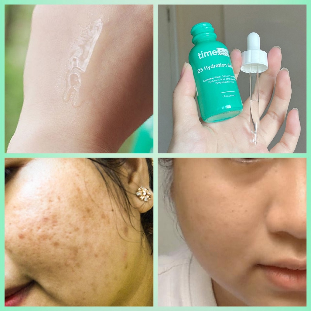 Tinh Chất Timeless Vitamin B5 +Serum Timeless B5