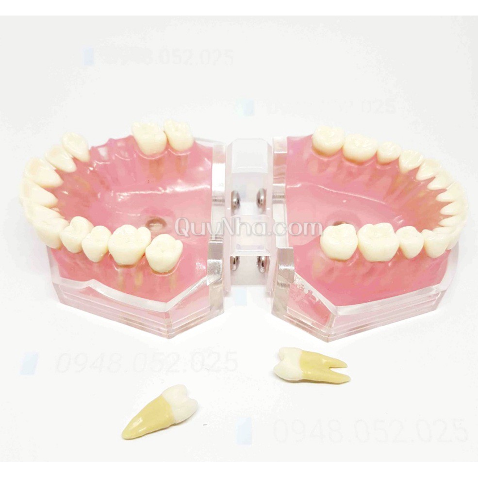 Mô hình rút răng thực hành nha khoa