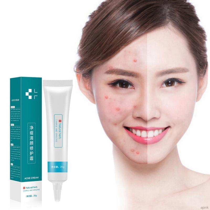 [Hàng mới về] Kem Giảm Mụn Dưỡng Ẩm Thu Nhỏ Lỗ Chân Lông Làm Săn Chắc Da 20g