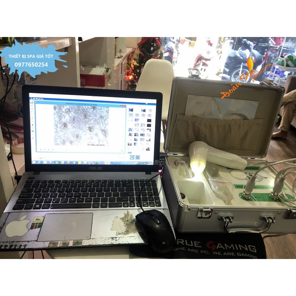 Máy soi da kết nối tivi dạng vali - Máy soi da TIVI