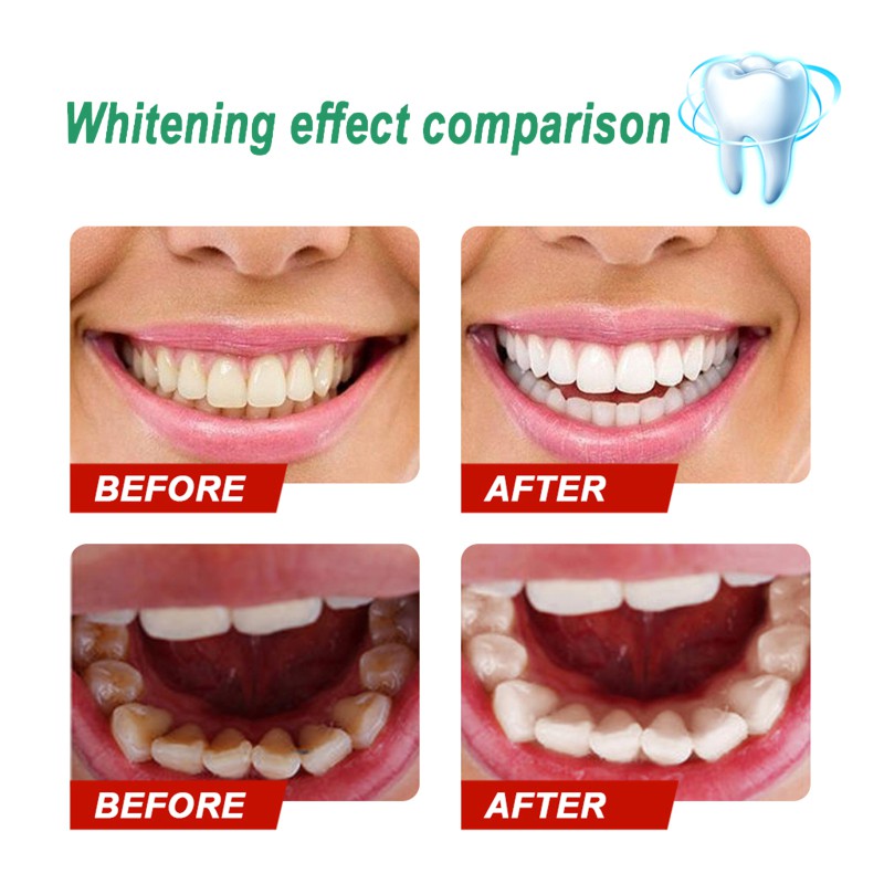 Bột Làm Trắng Răng Hiệu Quả Chất Lượng Cao