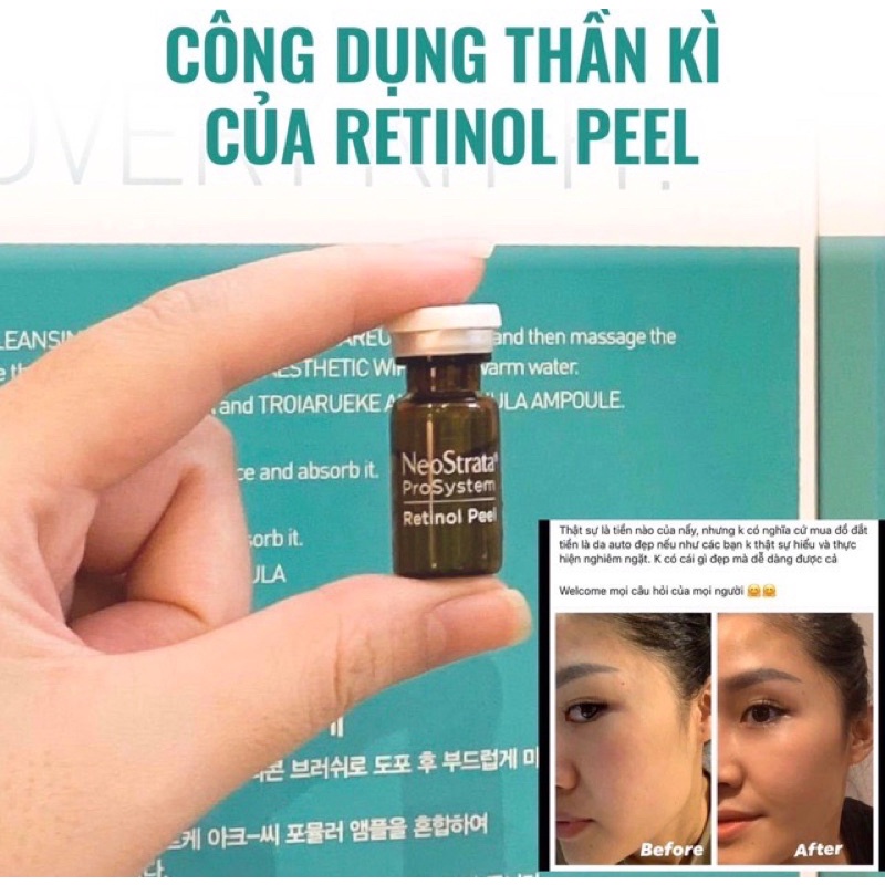 Peel da sinh học Neostrata Retinol Peel 1.5ml