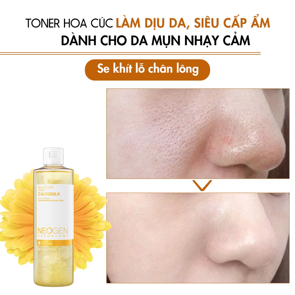 Toner Hoa Cúc Làm Dịu Da, Siêu Cấp Ẩm Cho Da Mụn Neogen Dermalogy Real Flower Toner CALENDULA 300ml