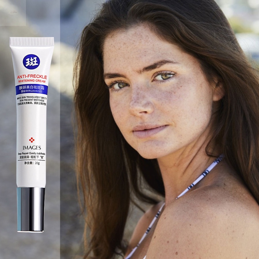 Kem hỗ trợ giảm tàn nhang 20g dưỡng ẩm làm trắng chăm sóc da