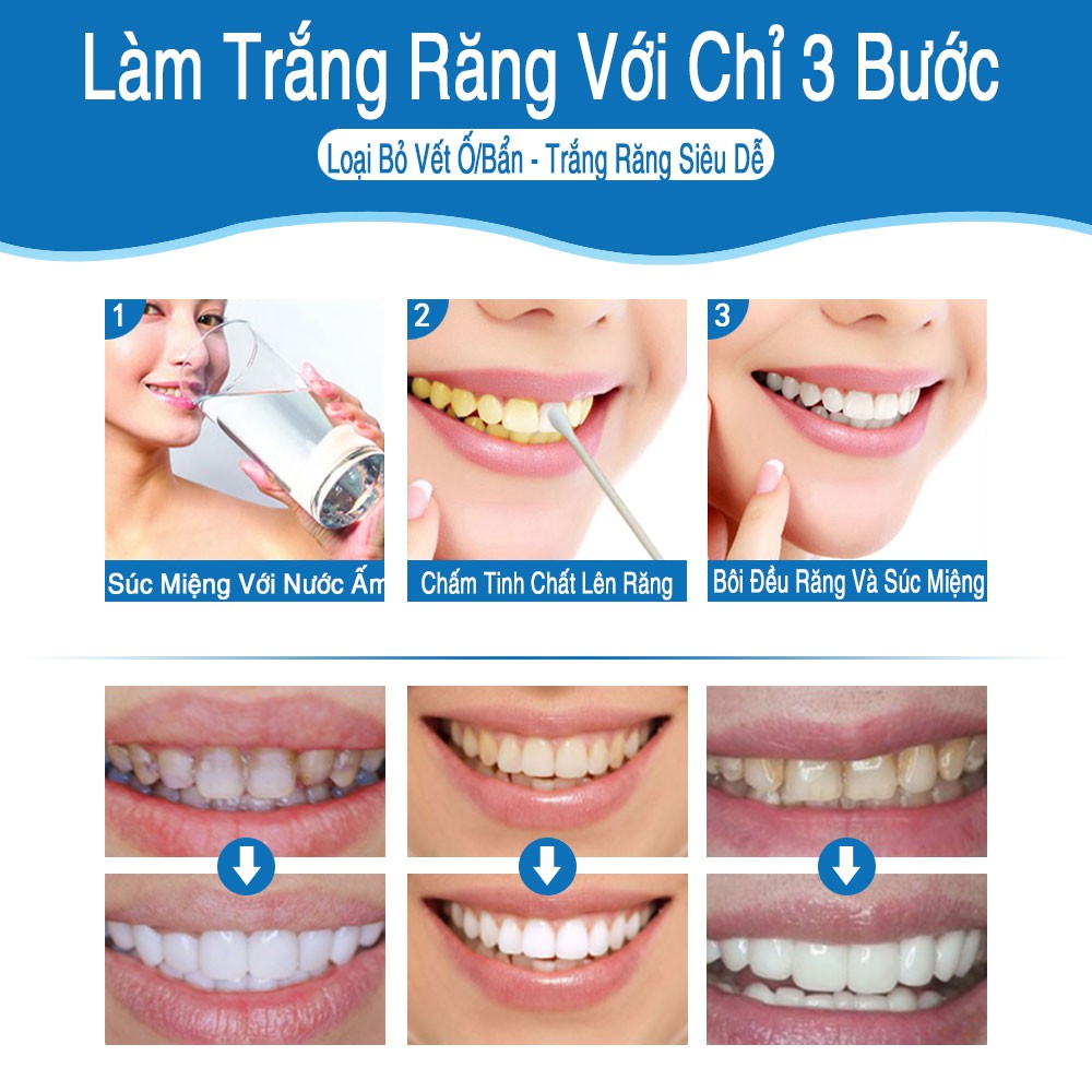 [ CHÍNH HÃNG ] Tinh Chất Tẩy Trắng Răng LANBENA TRẮNG RĂNG Làm Sạch Răng Teeth Clean Whitening Essence 10ml