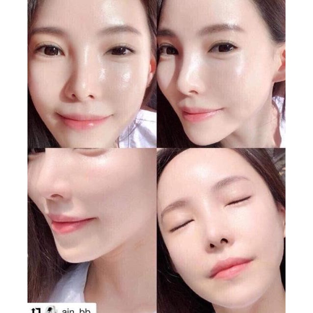 HG protein Collagen nhau thai tươi - Hàn Quốc