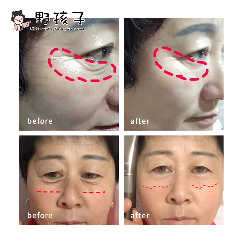 Yolo ❤ Đặt hàng để được mát xa! Korea Coreana Korea Botox Eye Cream, làm săn chắc và giảm nếp nhăn và quầng thâm 30ML | BigBuy360 - bigbuy360.vn