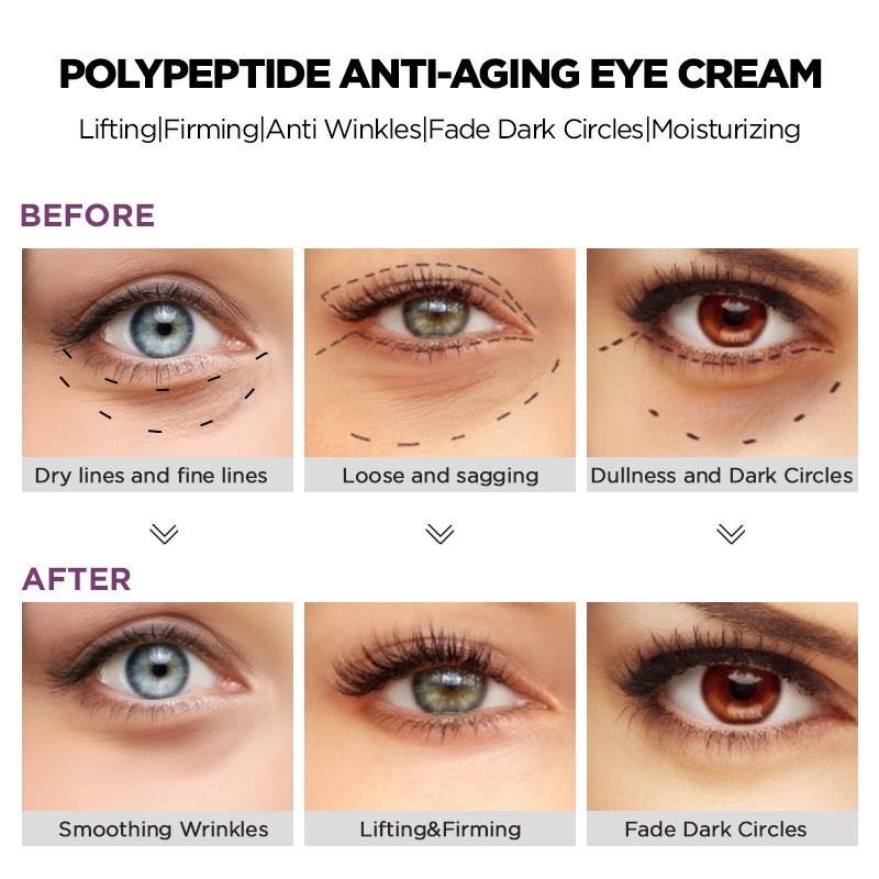 Kem Dưỡng Da Mắt Youngbook Chống Lão Hóa Giảm Nếp Nhăn Dưỡng Ẩm Và Nuôi Dưỡng Da Khô 15g | BigBuy360 - bigbuy360.vn