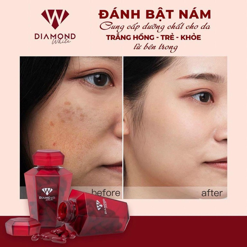 [HÀNG CHÍNH HÃNG] - Viên uống trắng da Diamond White Ngọc Trinh 2021 | WebRaoVat - webraovat.net.vn