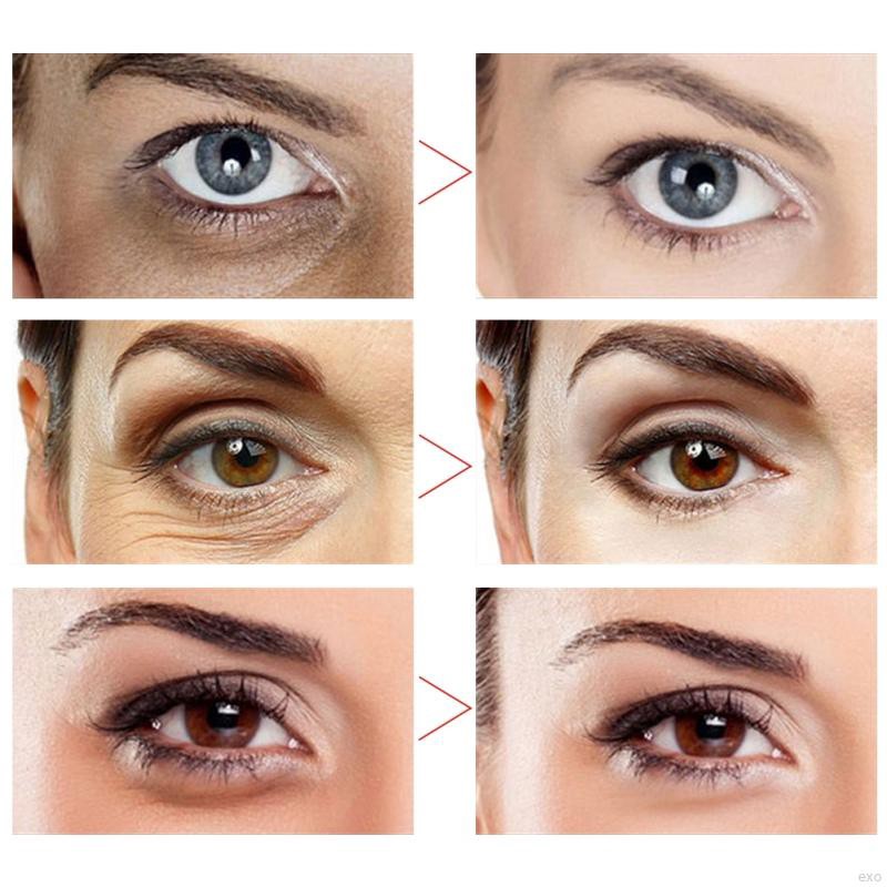 Thanh Lăn Mát Xa Mắt Loại Bỏ Quầng Thâm Và Bọng Mắt Hiệu Quả