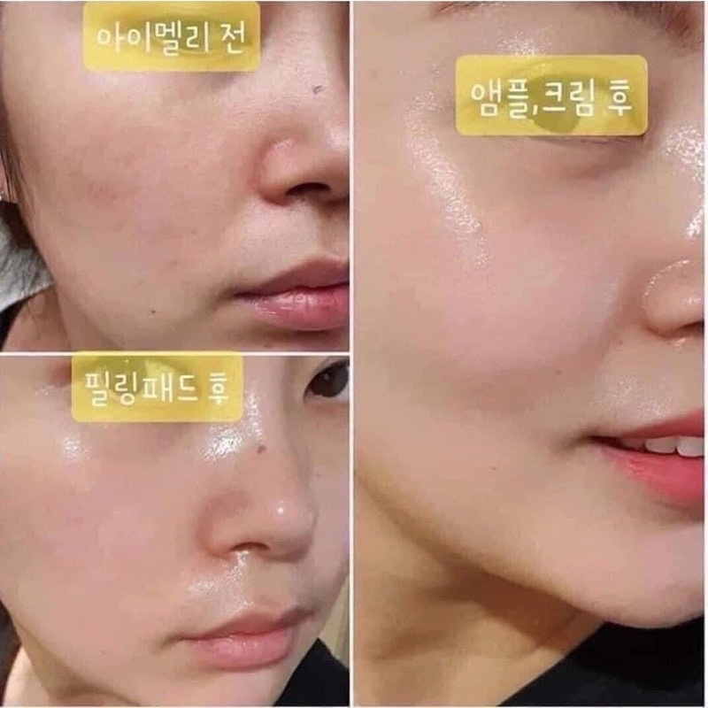 Tinh Chất Cấp Ẩm Hyaluron Complex Ampoule 62%,Vitamin C Hitolab