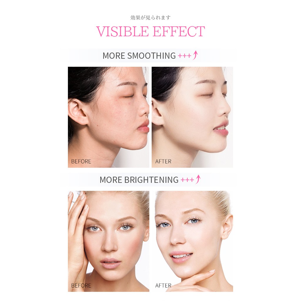 Kem dưỡng da mặt Hyaluronic Acid dưỡng ẩm chống lão hóa làm trắng da Laikou 25g | BigBuy360 - bigbuy360.vn