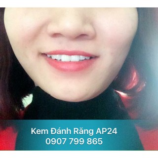 [CHUYÊN SỈ - INBOX] KEM ĐÁNH RĂNG AP24