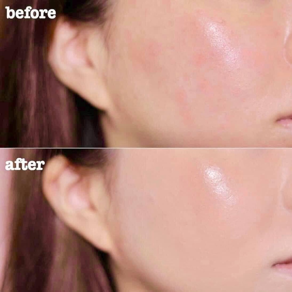 Mặt nạ phục hồi cấp ẩm Yuejin B5 Repair Control EGF