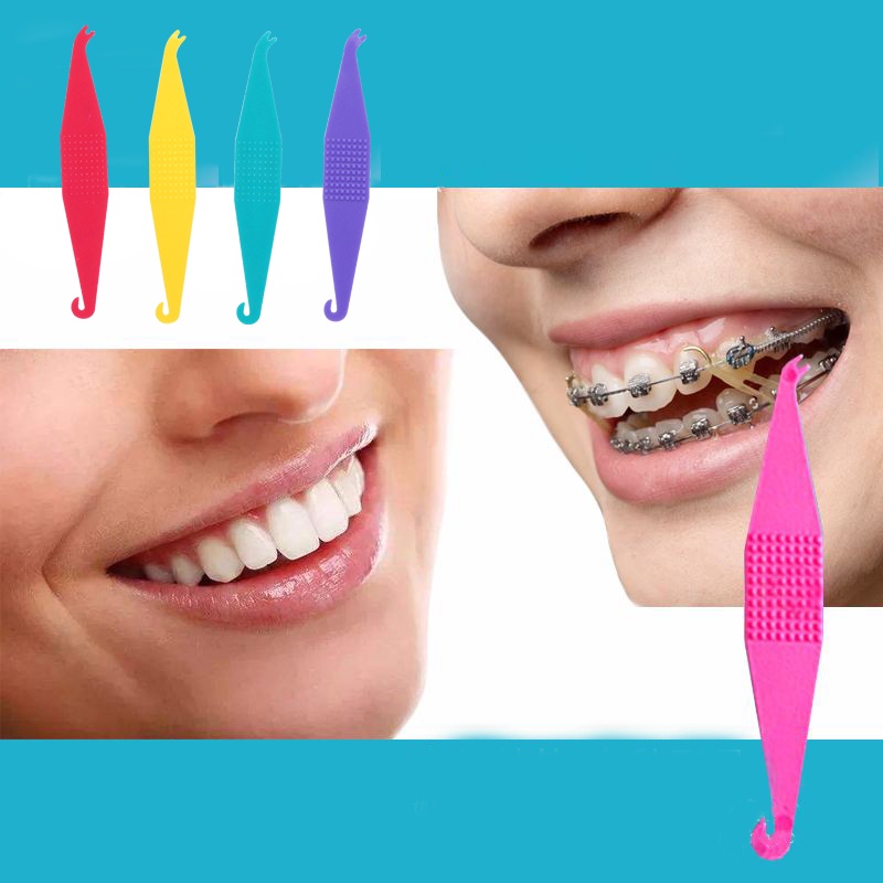 Set 100 Dây Cao Su Đàn Hồi Chỉnh Hình Răng Nhiều Màu Sắc