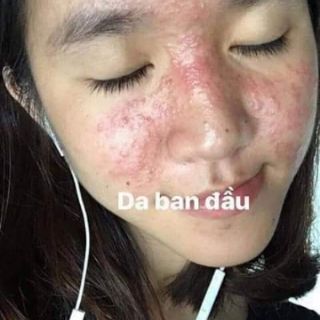 TIÊN TIÊN DƯỢC handmade