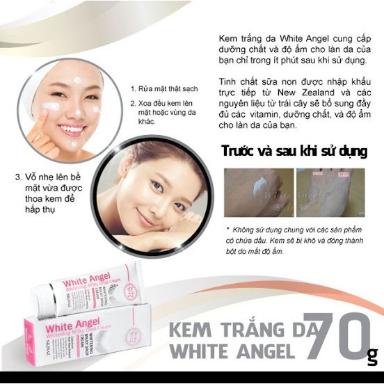 [ Siêu sale ] kem White Angel SkinAz