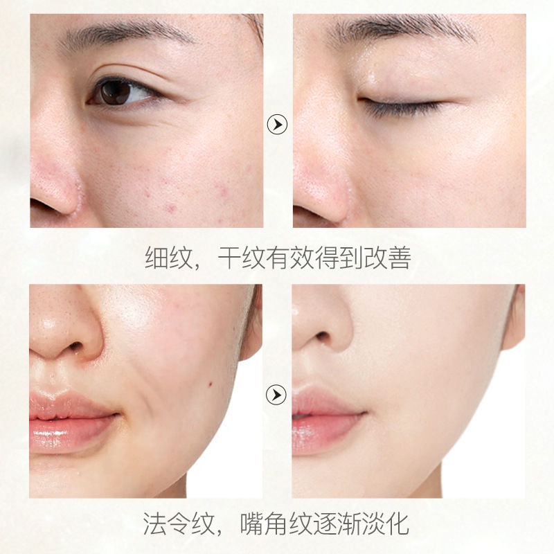 ★Tinh Chất Hexapeptide Trẻ Hóa Da Dưỡng Ẩm Làm Mờ Nếp Nhăn | BigBuy360 - bigbuy360.vn
