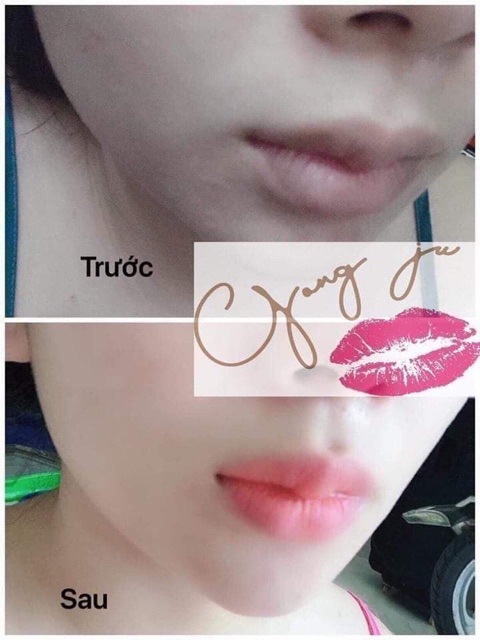 Ủ môi gong ju hàn quốc | BigBuy360 - bigbuy360.vn