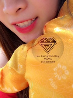 Kim cương nhân tạo đính răng