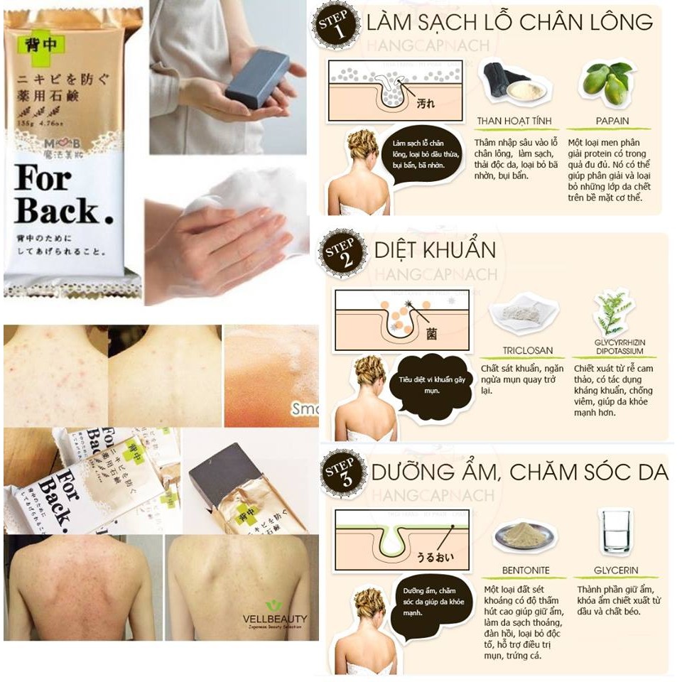 Xà phòng mụn lưng For Back Medicated Soap